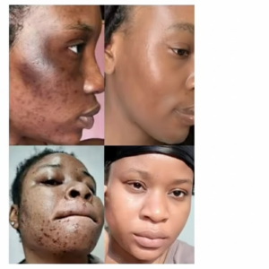 Lotion Tonique Acide Glycolique 7% Exfoliante de THE ORDINARY lotion tonique acide glycolique 7% exfoliante de the ordinary