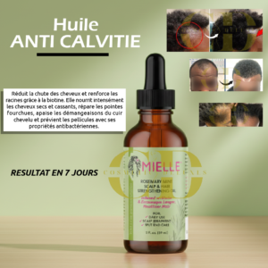 huile anti calvitie au romarin et menthe – renforce les racines et stoppe la chute