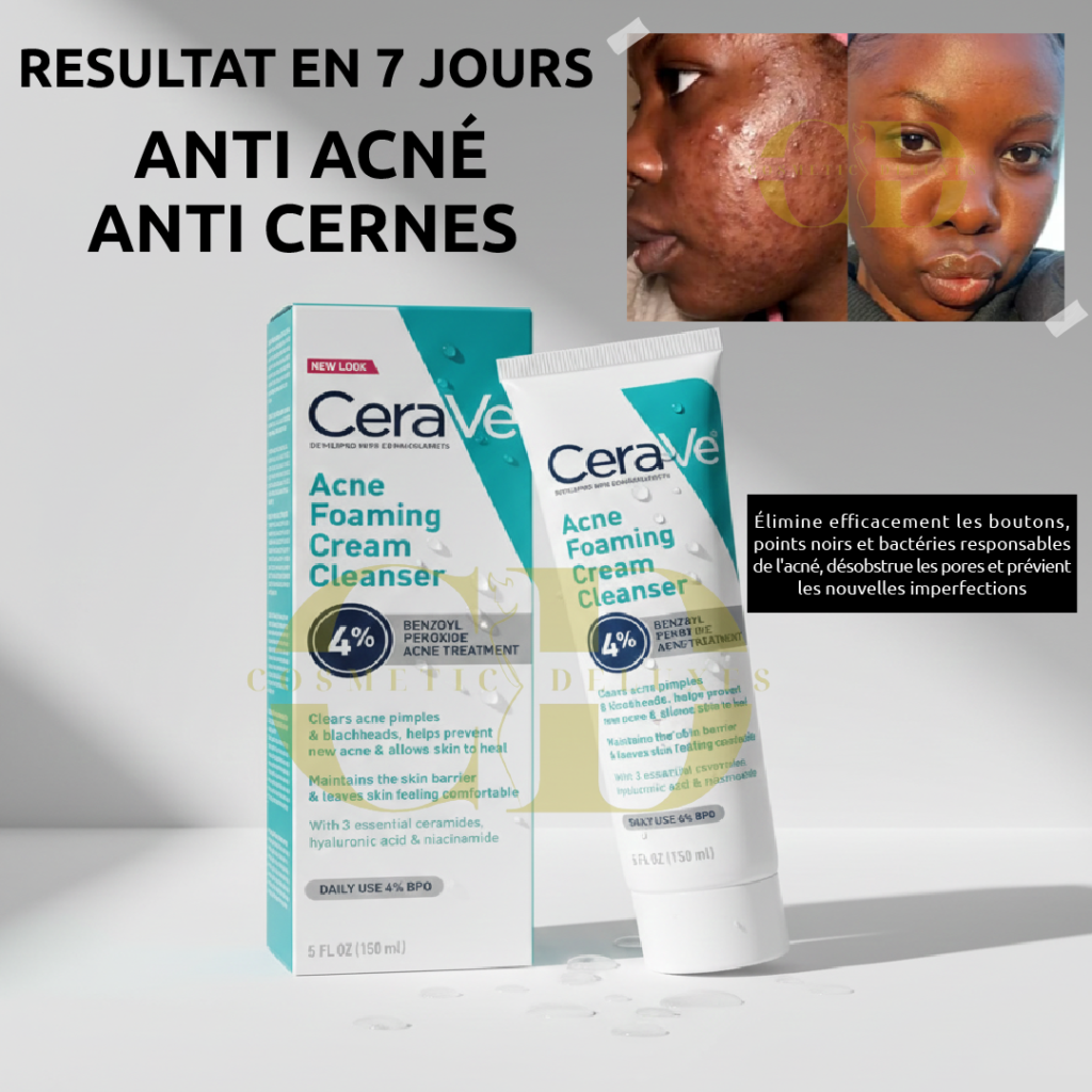 nettoyant crème moussant anti acné cerave : solution intense boutons et points noirs